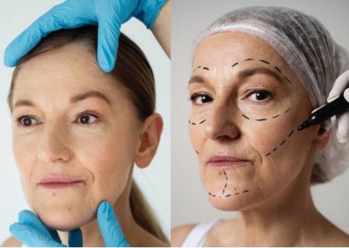 Why Surgical Facelift Treatment in Jaipur Is the Gold Standard for Facial Rejuvenation 