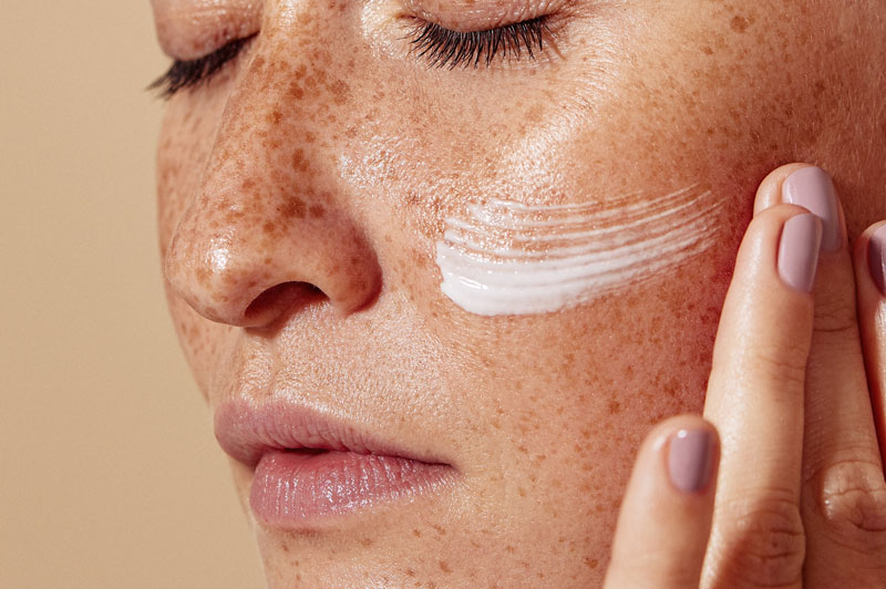 Pigmentation Corrections in Sri Ganganagar