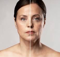 Surgical Facelift in Sri Ganganagar