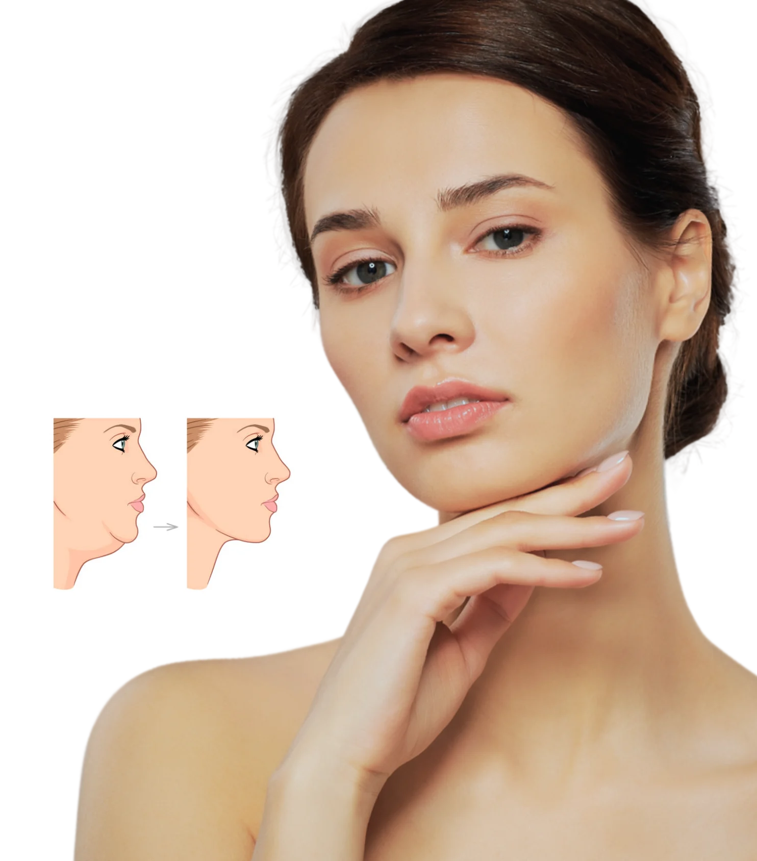 Double Chin Reduction in Sri Ganganagar