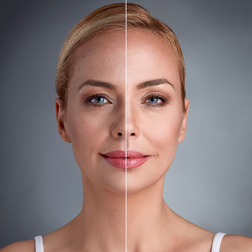 Face Fat Grafting in Sri Ganganagar