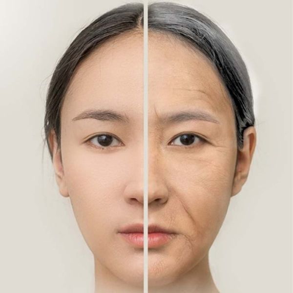 Face Fat Grafting in Sri Ganganagar