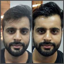 Korean Glass Treatment in Sri Ganganagar