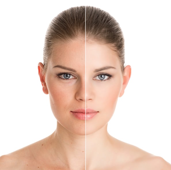Non-Surgical Facial Treatment in Sri Ganganagar