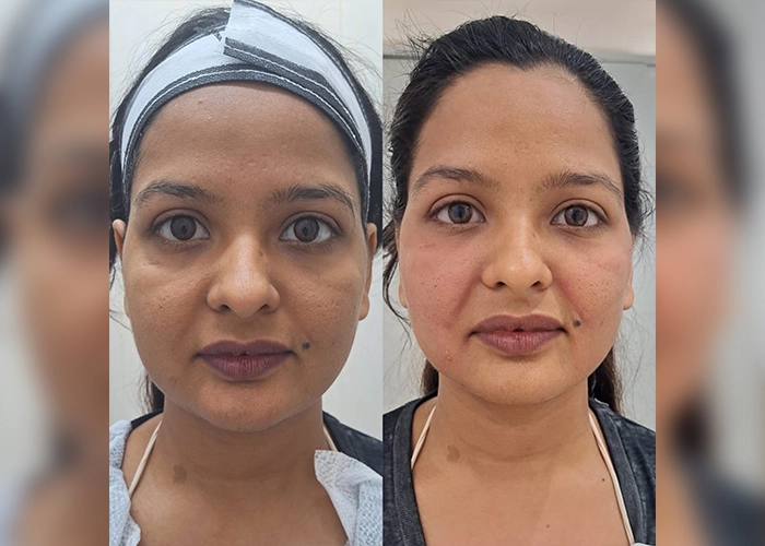 Surgical Face Makeover in Sri Ganganagar