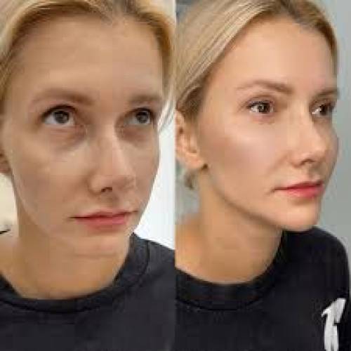 Face Features Correction in Sri Ganganagar