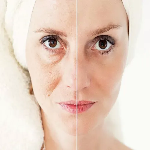 Non-Surgical Facial Treatment in Sri Ganganagar